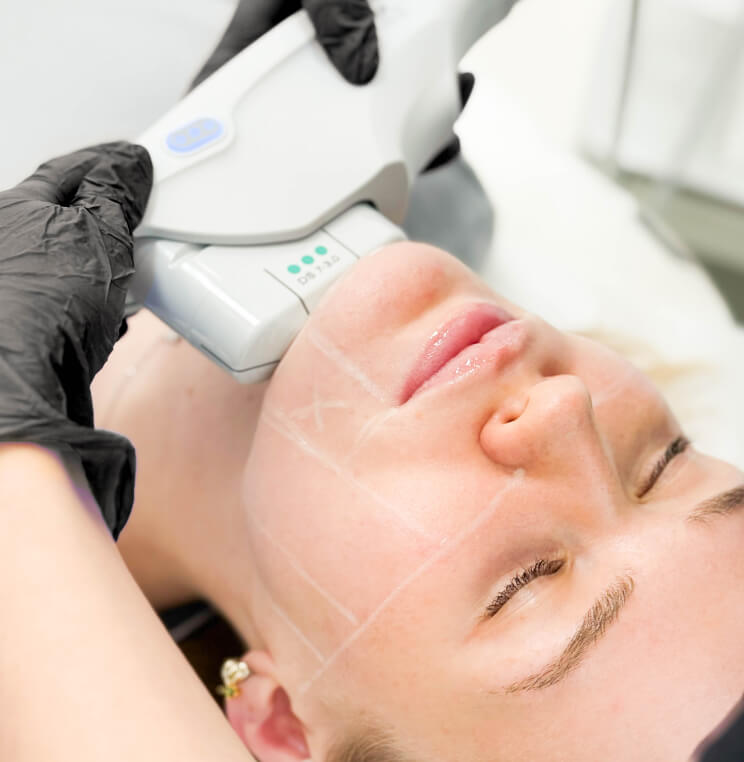 ULTHERAPY Ultherapy Skin Tightening Vancouver | EverYoung Skin Clinic