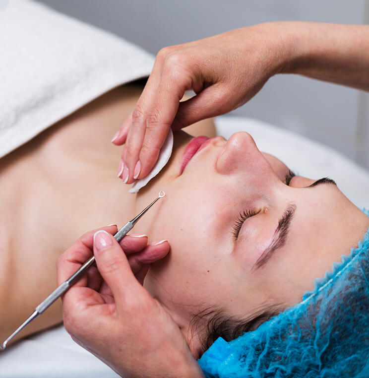 acne-treatments-clinic Acne Treatments Vancouver | EverYoung Skin Clinic