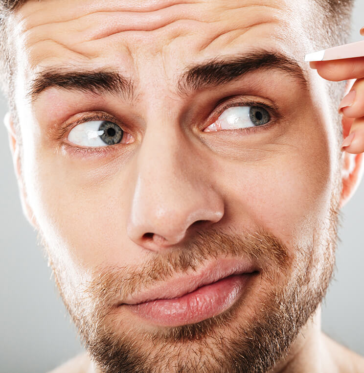 Conditions: Wrinkles - Men | EverYoung Skin Clinic