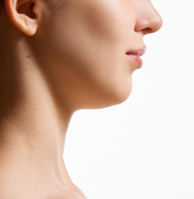 Conditions: Double Chin | EverYoung Skin Clinic