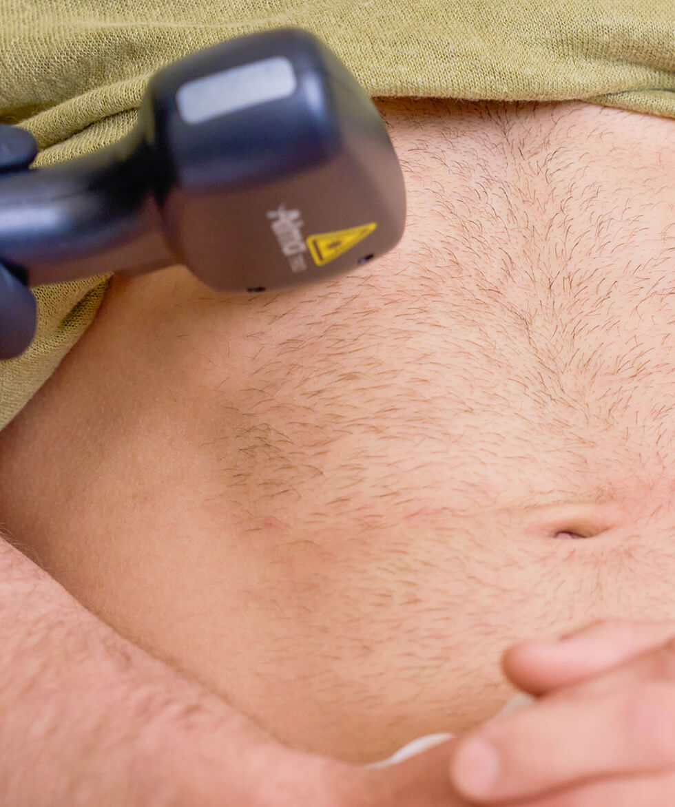 laser-hair-removal-port-coquitlam Laser Hair Removal in Vancouver, Burnaby, North Vancouver, and Port Coquitlam | EY